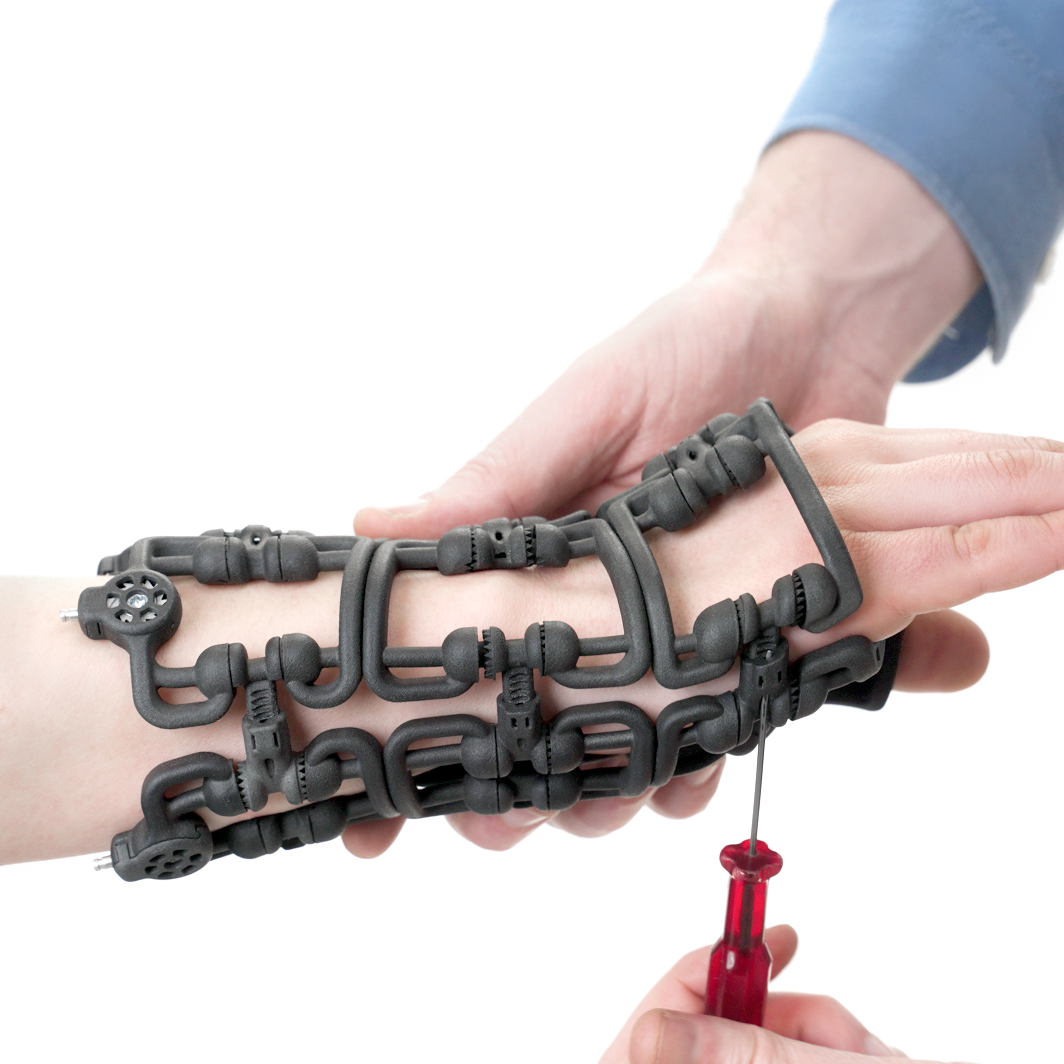 AI-driven brace manufacturing workflow