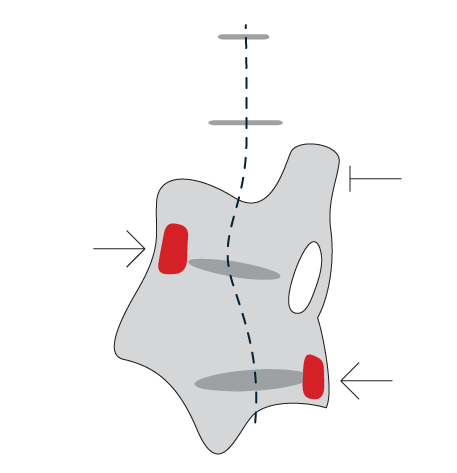 Brace library reference image 5