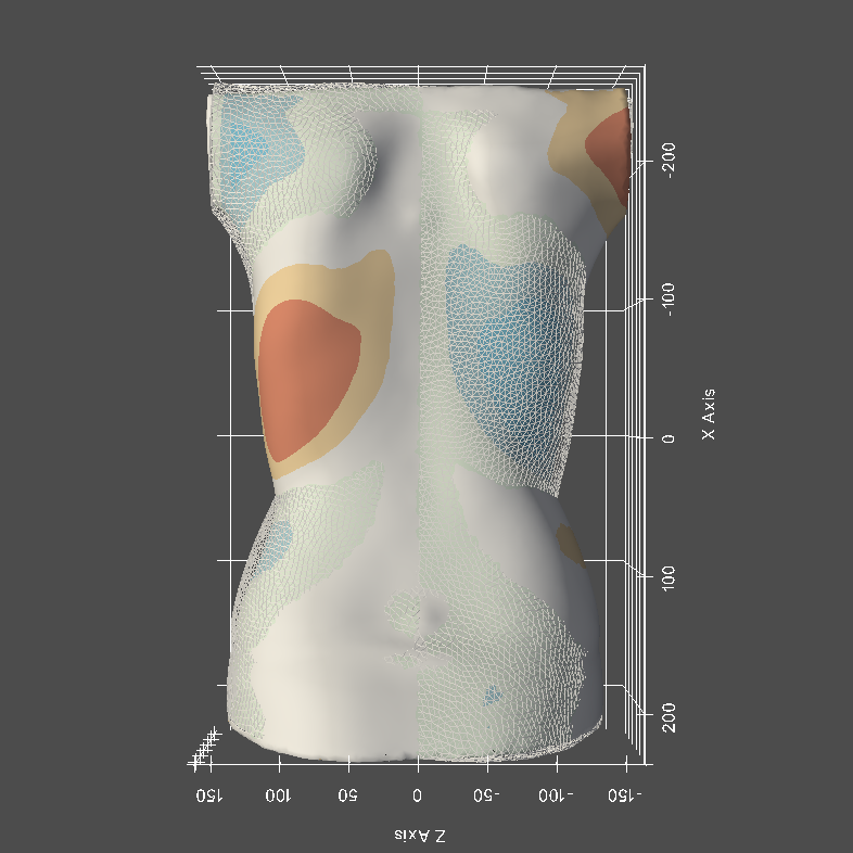 AI technology for brace classification